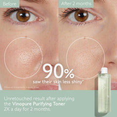 Caudalie Vinopure toner on cotton pad for cleansing and mattifying use.