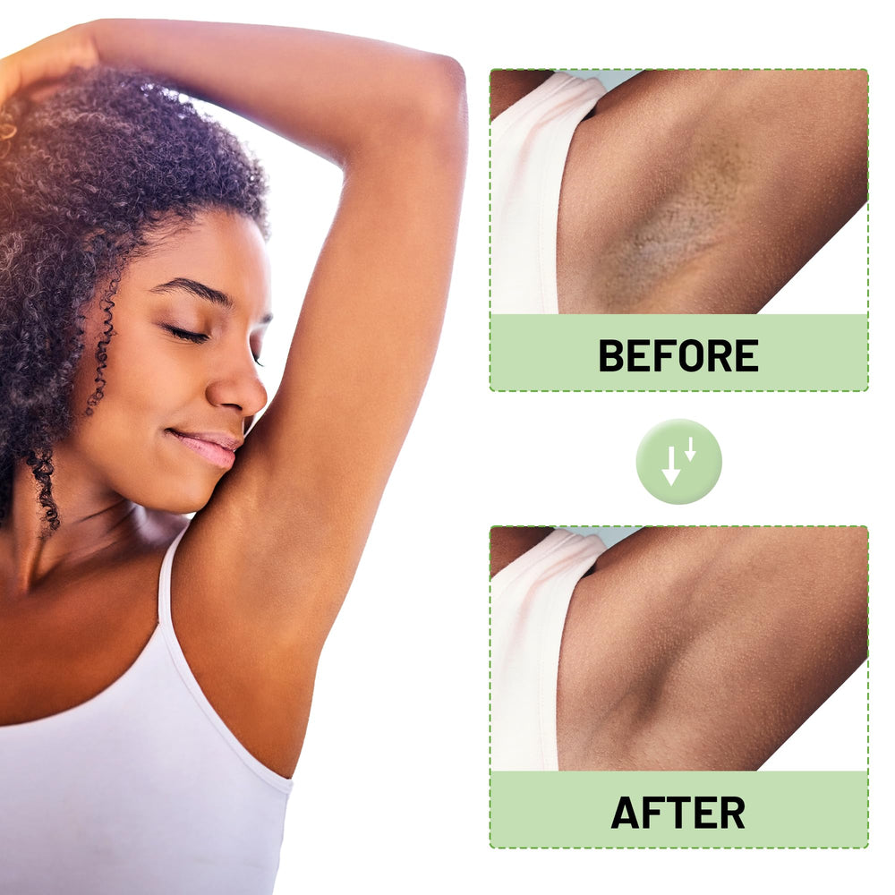 Ceavo Skin Bleaching Cream ingredients niacinamide arbutin demonstrate brightening support