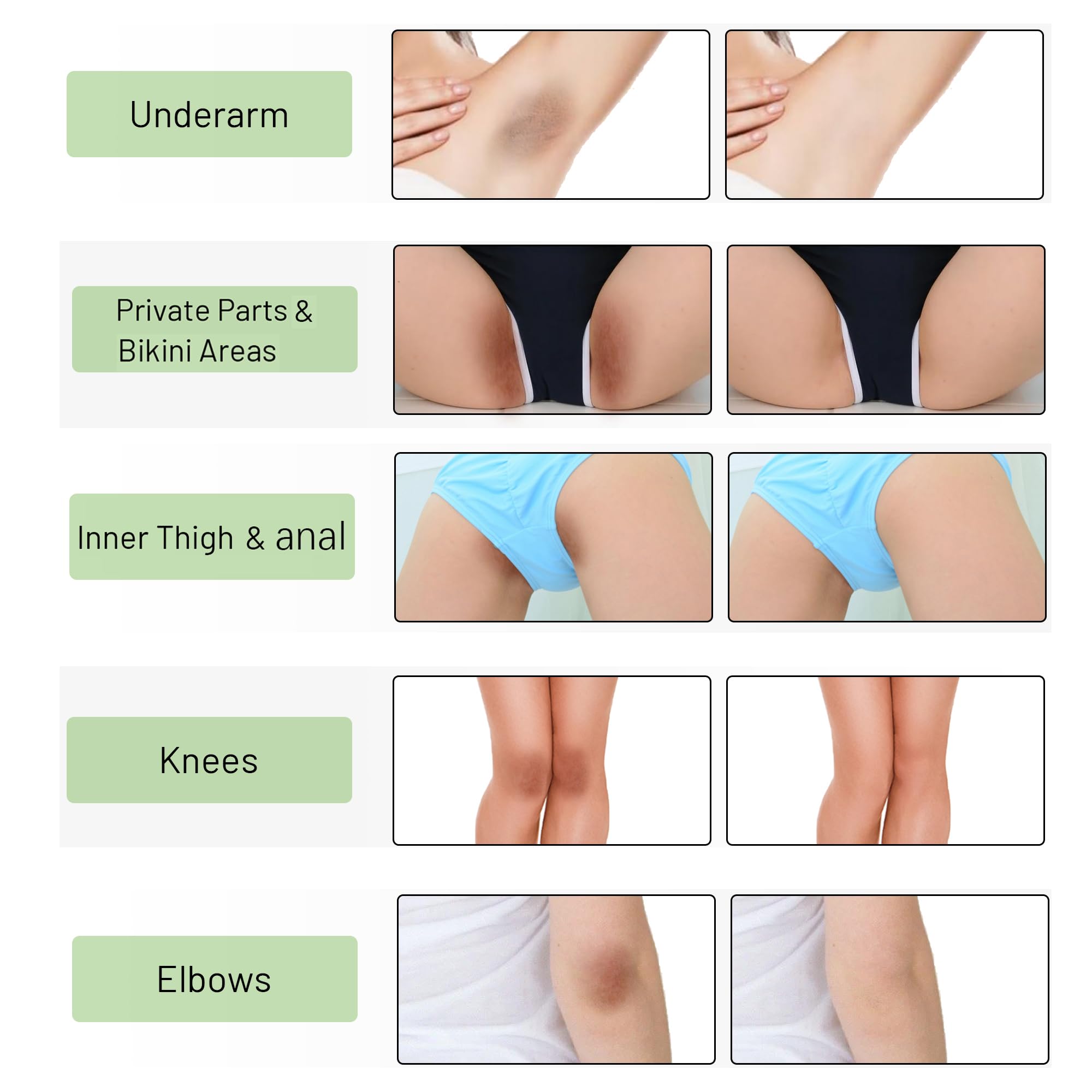 Ceavo Skin Bleaching Cream knees and elbows image suggests balanced complexion