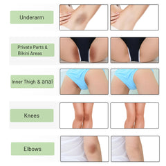 Ceavo Skin Bleaching Cream knees and elbows image suggests balanced complexion