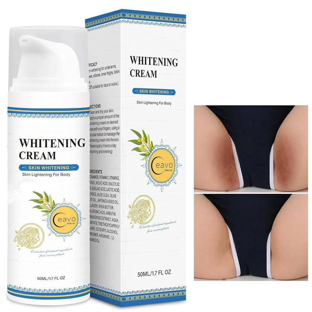 Ceavo Skin Whitening Cream bottle close-up shows gentle daily-use formula for all skin tones.