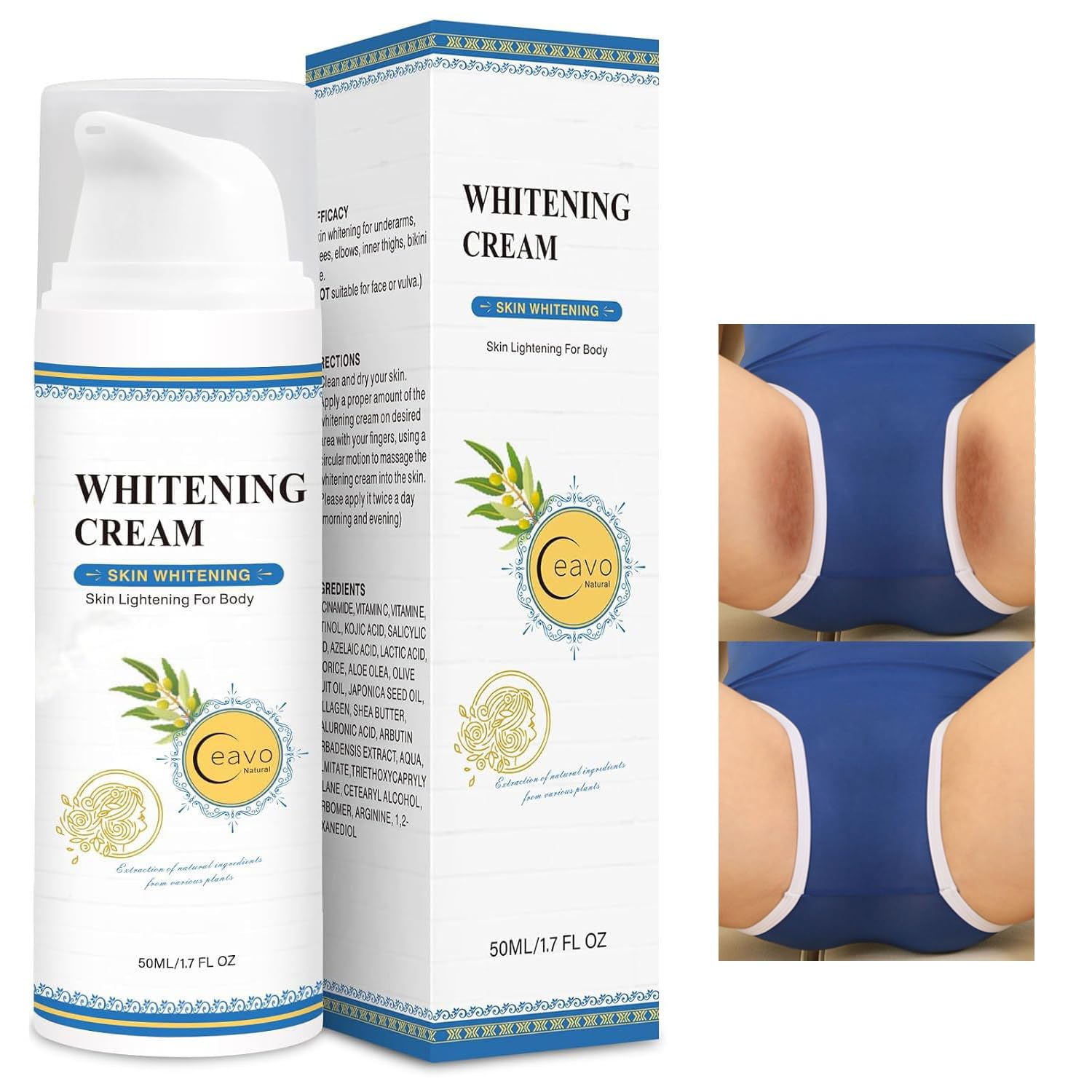 Ceavo Skin Whitening Cream brand-identity shot reinforces gentle, safe-care messaging.
