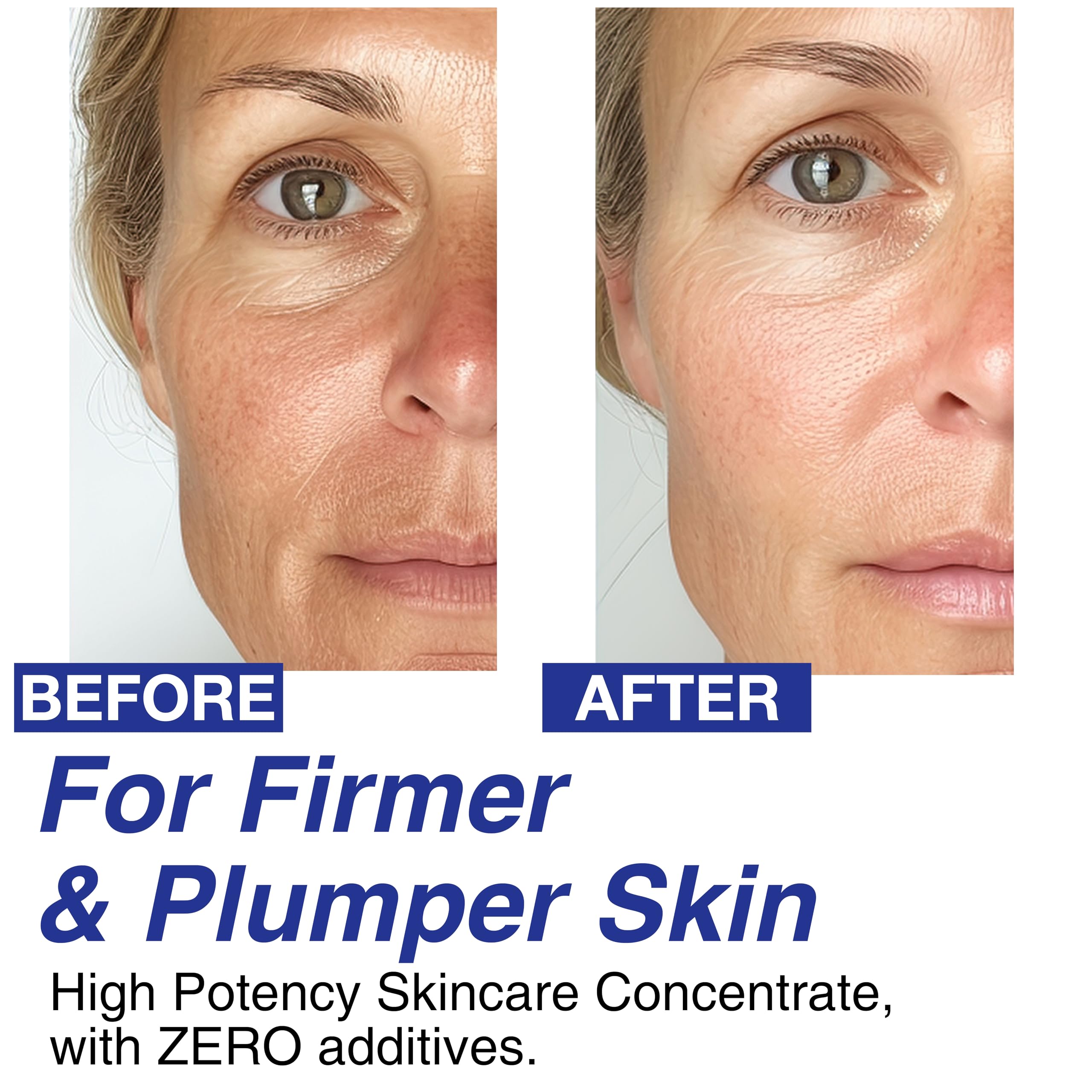 CELDYQUE skin-firming serum application along the jawline for contour support