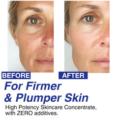 CELDYQUE skin-firming serum application along the jawline for contour support