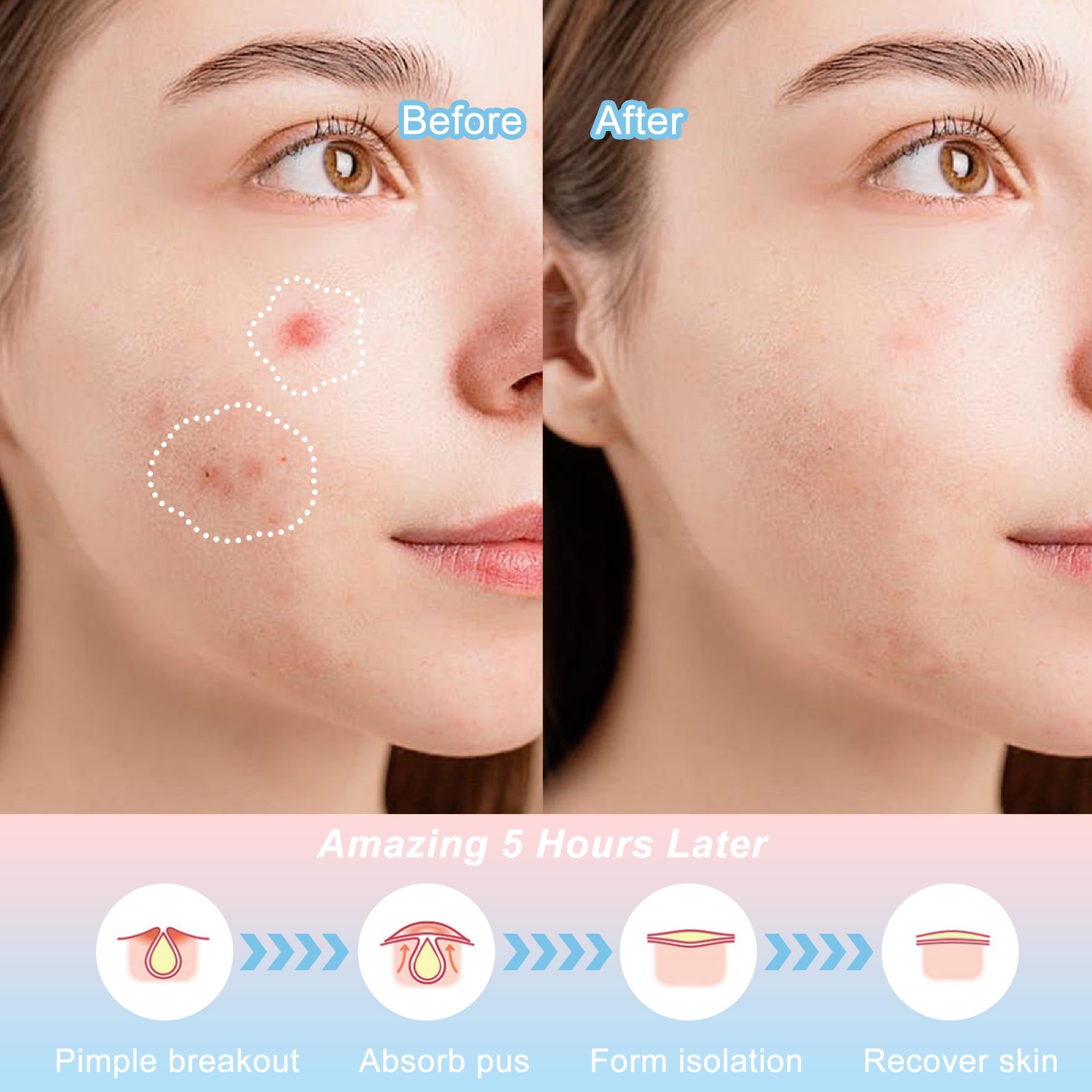 CELECARE salicylic-acid patch targets pores for clearer appearance.