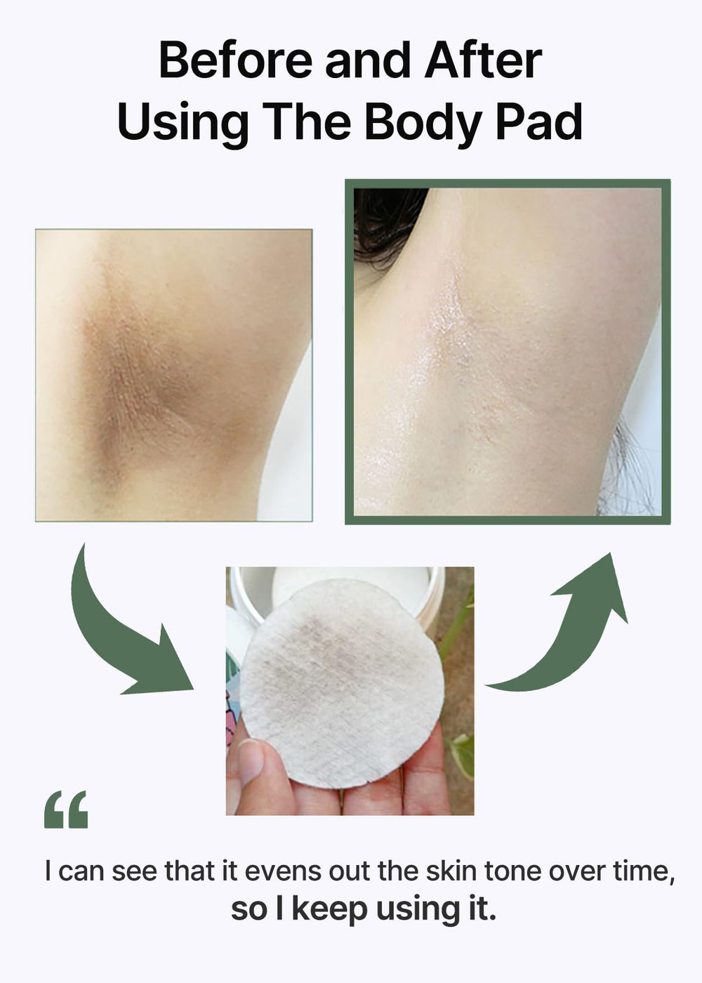 Celimax ONE STEP Body Brightening Pad knee elbow area emphasizes smoothing of rough skin