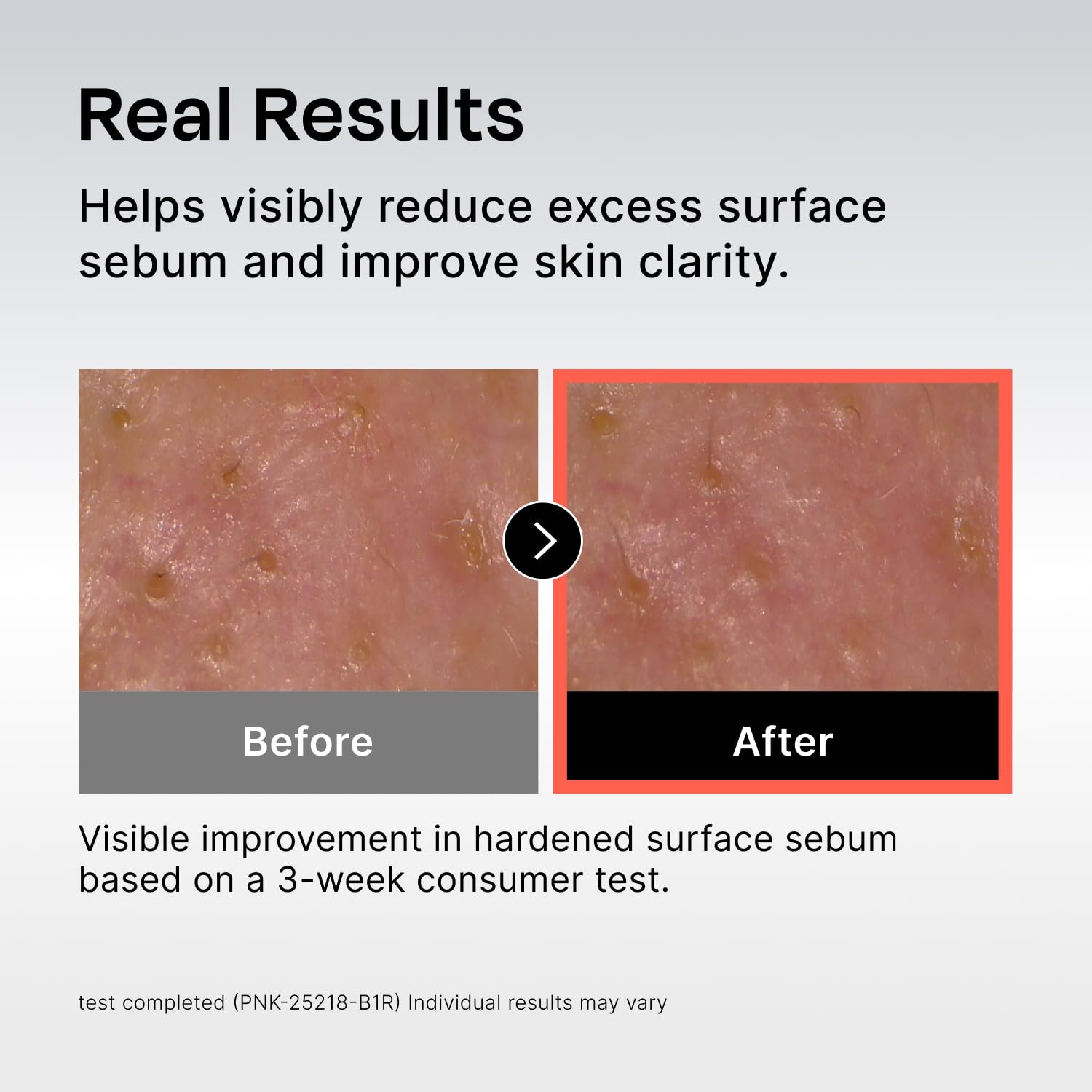 Celladix Sebum Rebalancing Rx 131 Ampoule packaging box suggests a simple daily routine.