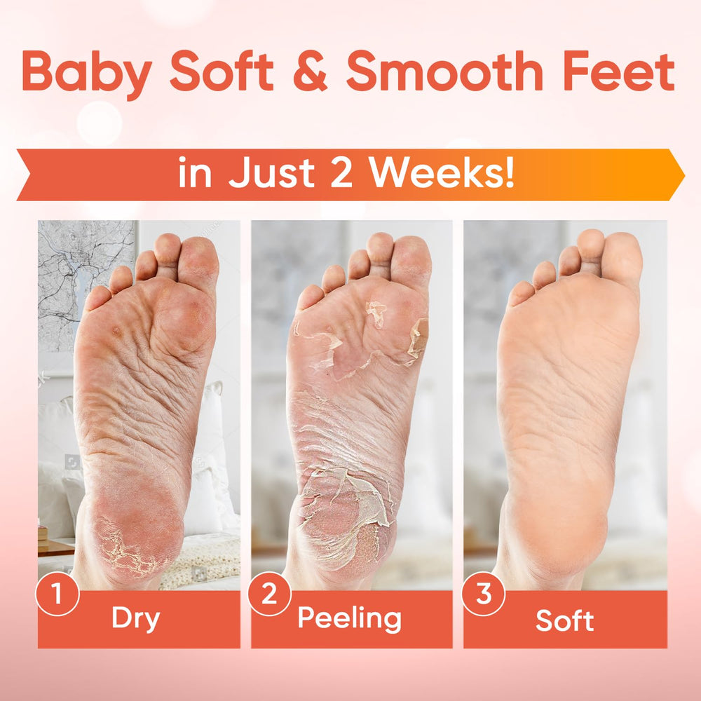 CÉLOR Foot Peel Mask booties with lavender scent for soothing care