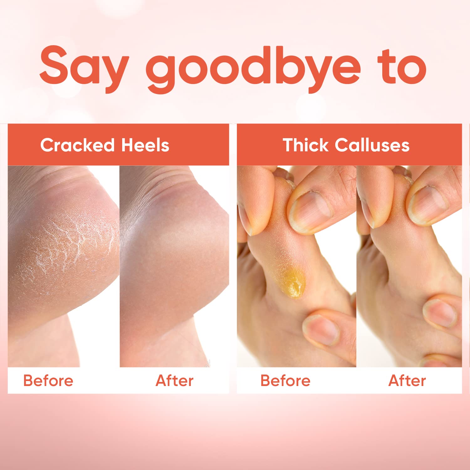 CÉLOR Foot Peel Mask after use shows softer feet