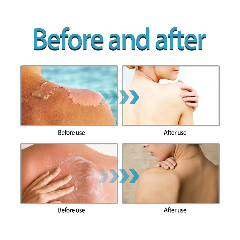 Centella Sunscreen leaves a soft glow without a greasy finish.