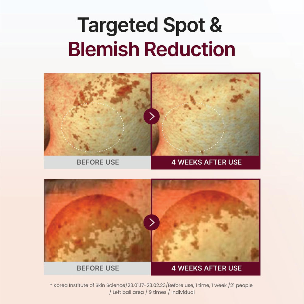 CENTELLIAN 24 Madeca Mela Capture Ampoule Pad after-use glow suggesting even skin tone.