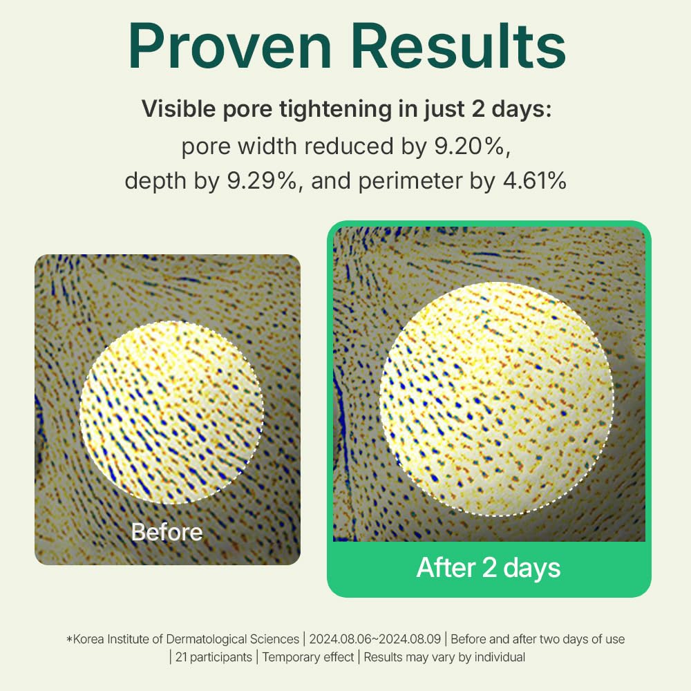 Centellian 24 Madeca Powder Tea Tree AC pore-tightening effect with micro-powder finish.