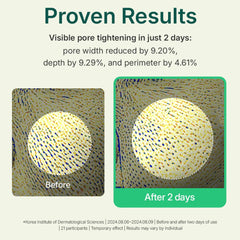 Centellian 24 Madeca Powder Tea Tree AC pore-tightening effect with micro-powder finish.