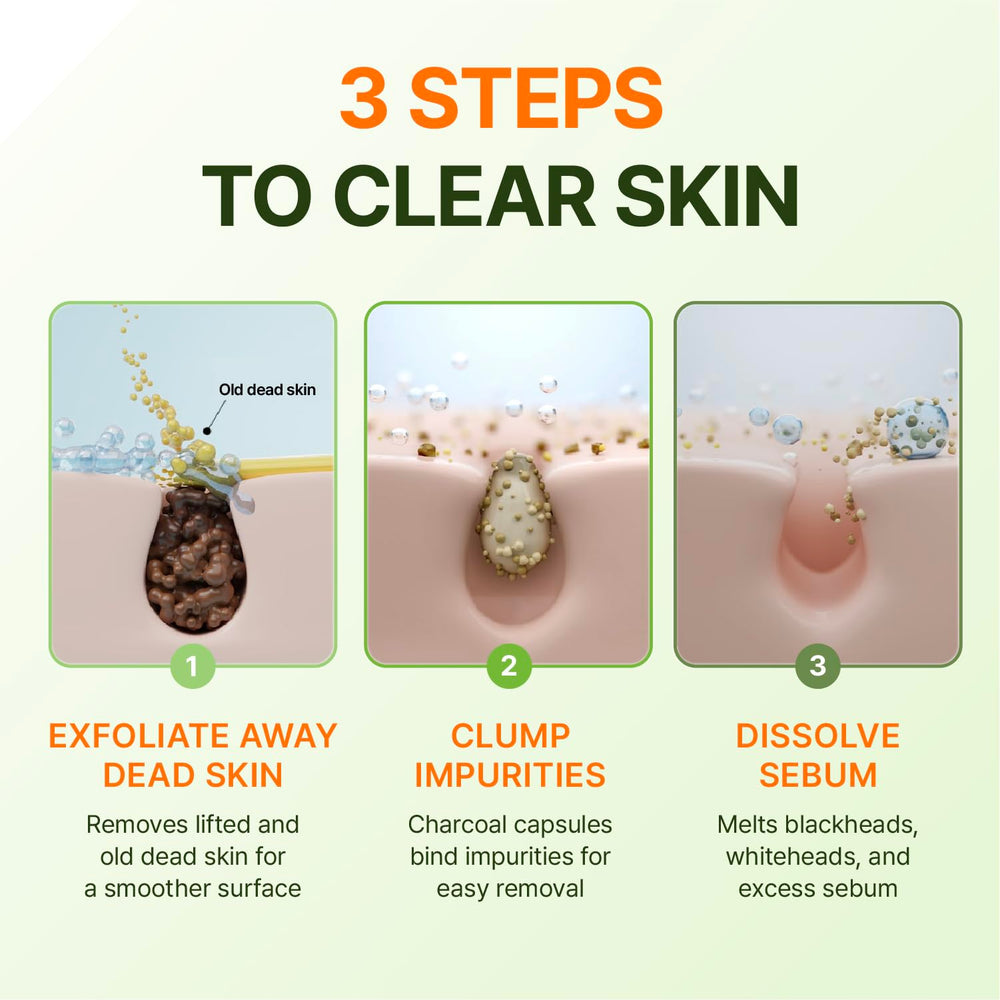 Centellian 24 Madeca Matcha Toning Peeling Gel application scene emphasizes pore care.