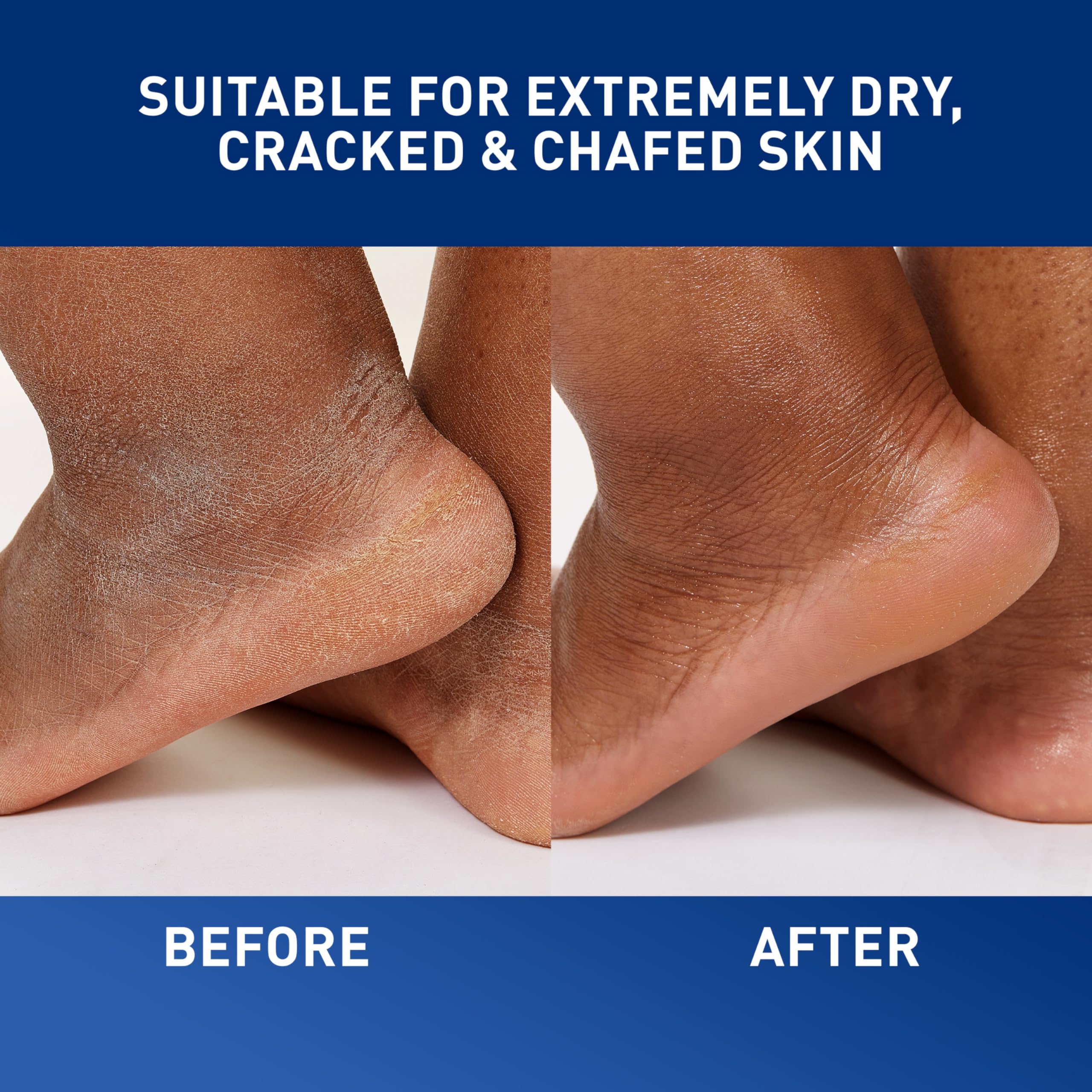 Before and after feet image using CeraVe Healing Ointment illustrating reduced cracking