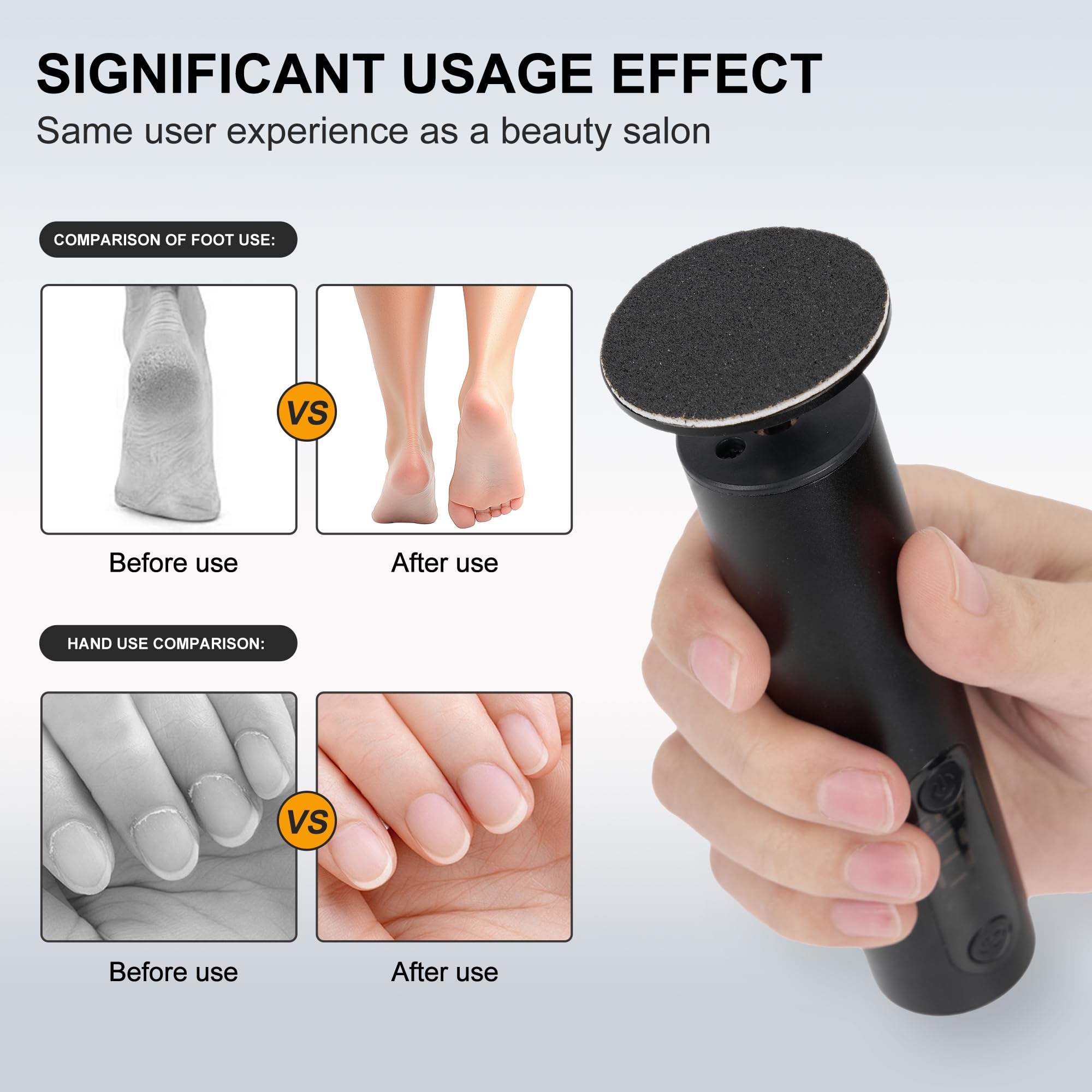 Cesekao electric foot sander showing speed dial reveals 9 adjustable speeds for tailored exfoliation.