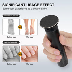 Cesekao electric foot sander showing speed dial reveals 9 adjustable speeds for tailored exfoliation.
