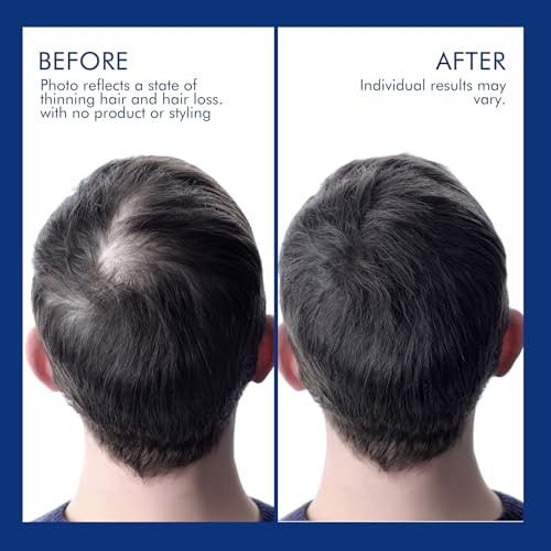 Ceson&Cesun rosemary biotin shampoo ingredients close-up highlights zinc and biotin benefits