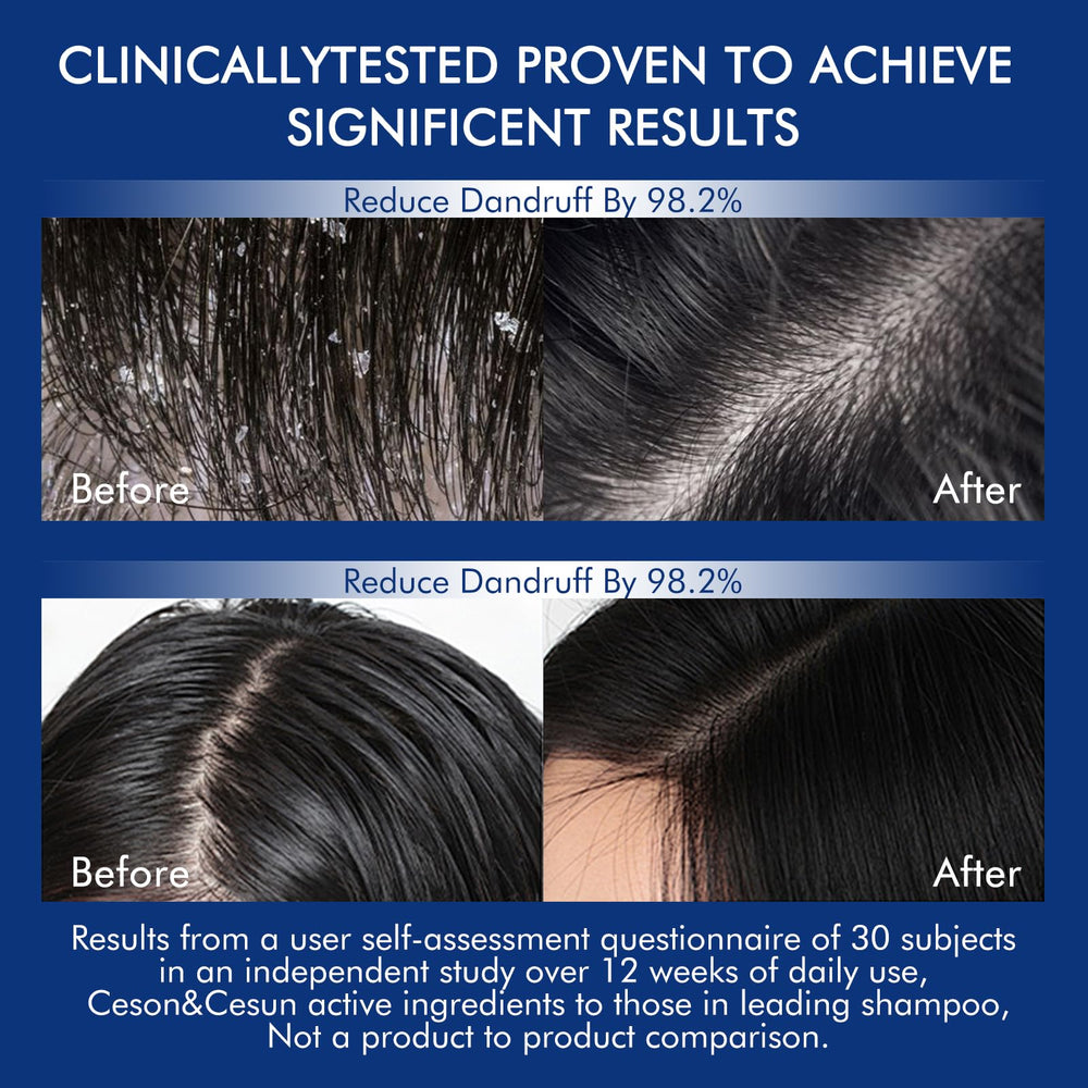 Ceson&Cesun rosemary biotin shampoo emphasizes naturally derived, nourishing oils