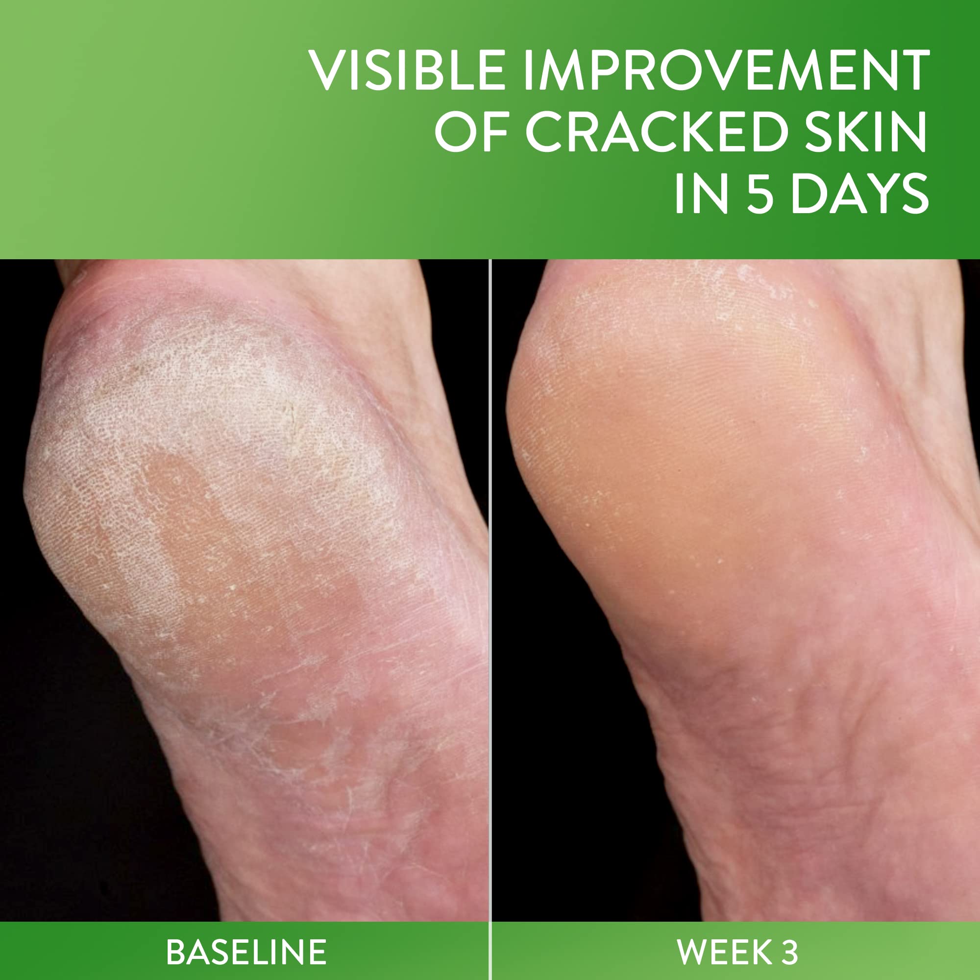Cetaphil Cracked Skin Repair Balm close-up emphasizes glycerin hydration for softened rough skin.