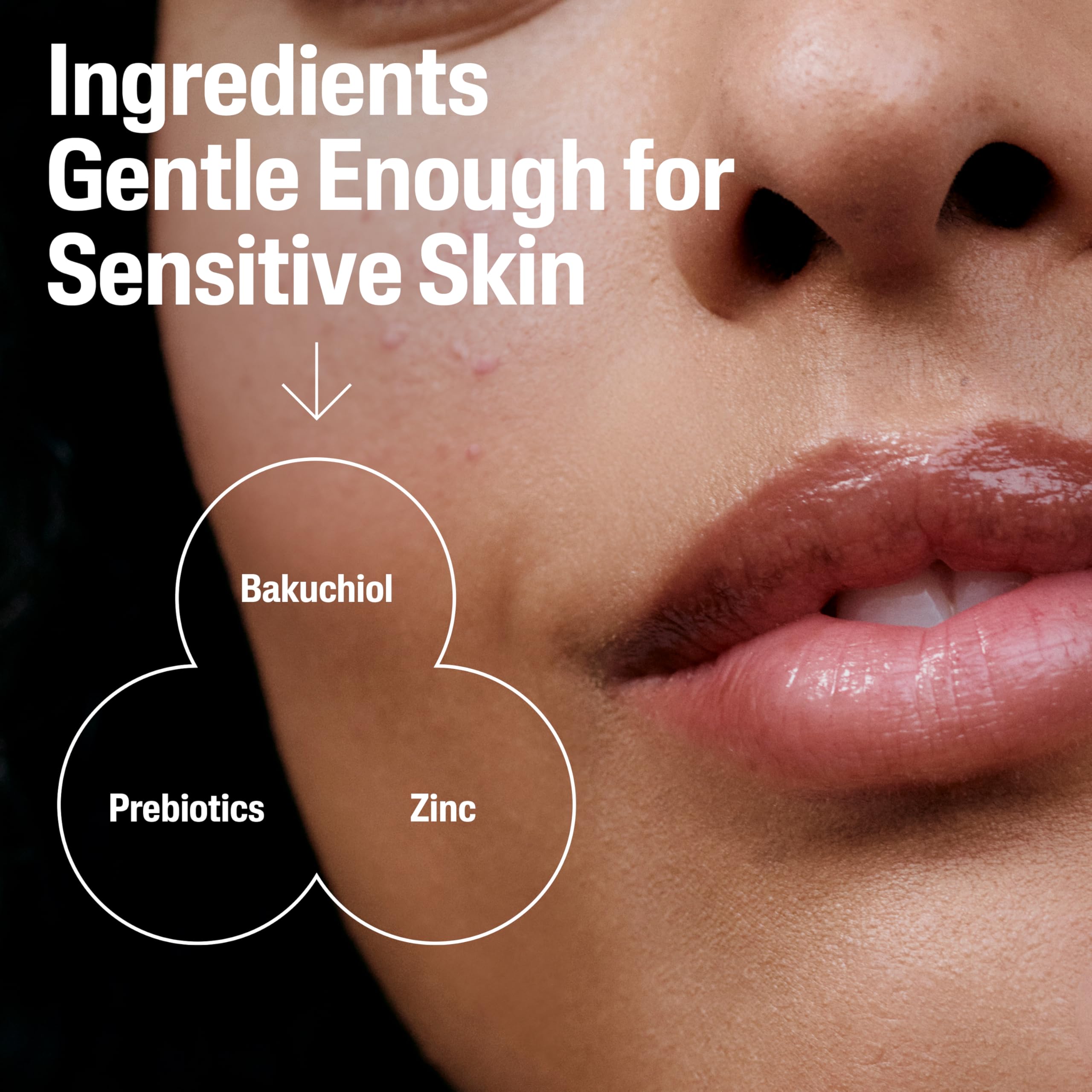 Cetaphil zinc and prebiotics aiding skin barrier close-up