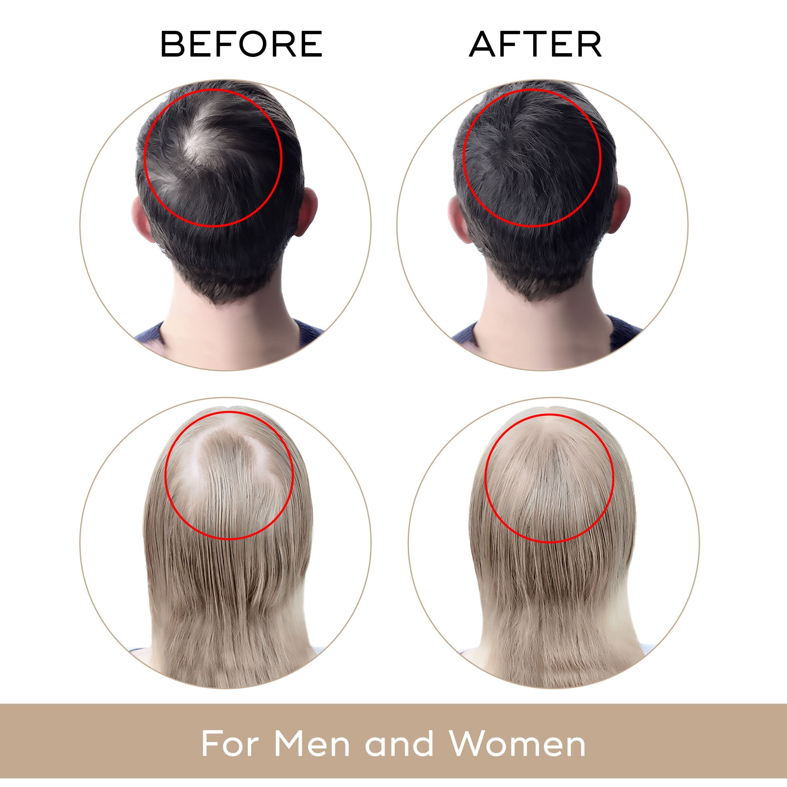 Charismo USA Dekohair serum drop on palm shows controlled scalp application.