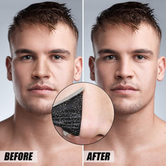 Charmonic charcoal nose strip application showing easy, mess-free pore cleansing.