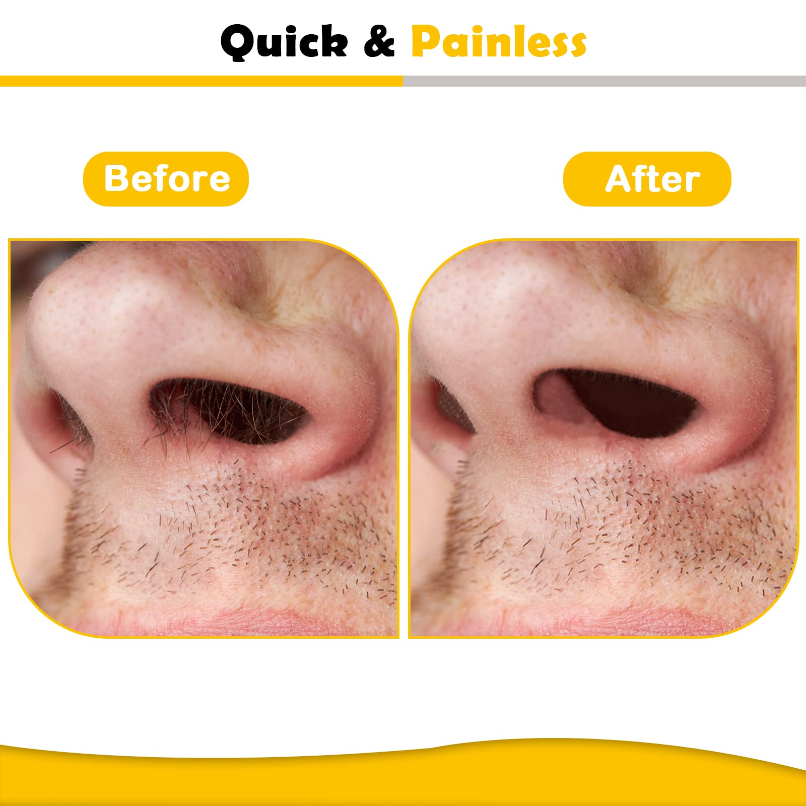 Charmonic nose wax kit in use showing quick, clean nostril hair removal.
