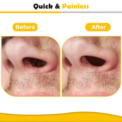 Charmonic nose wax kit in use showing quick, clean nostril hair removal.