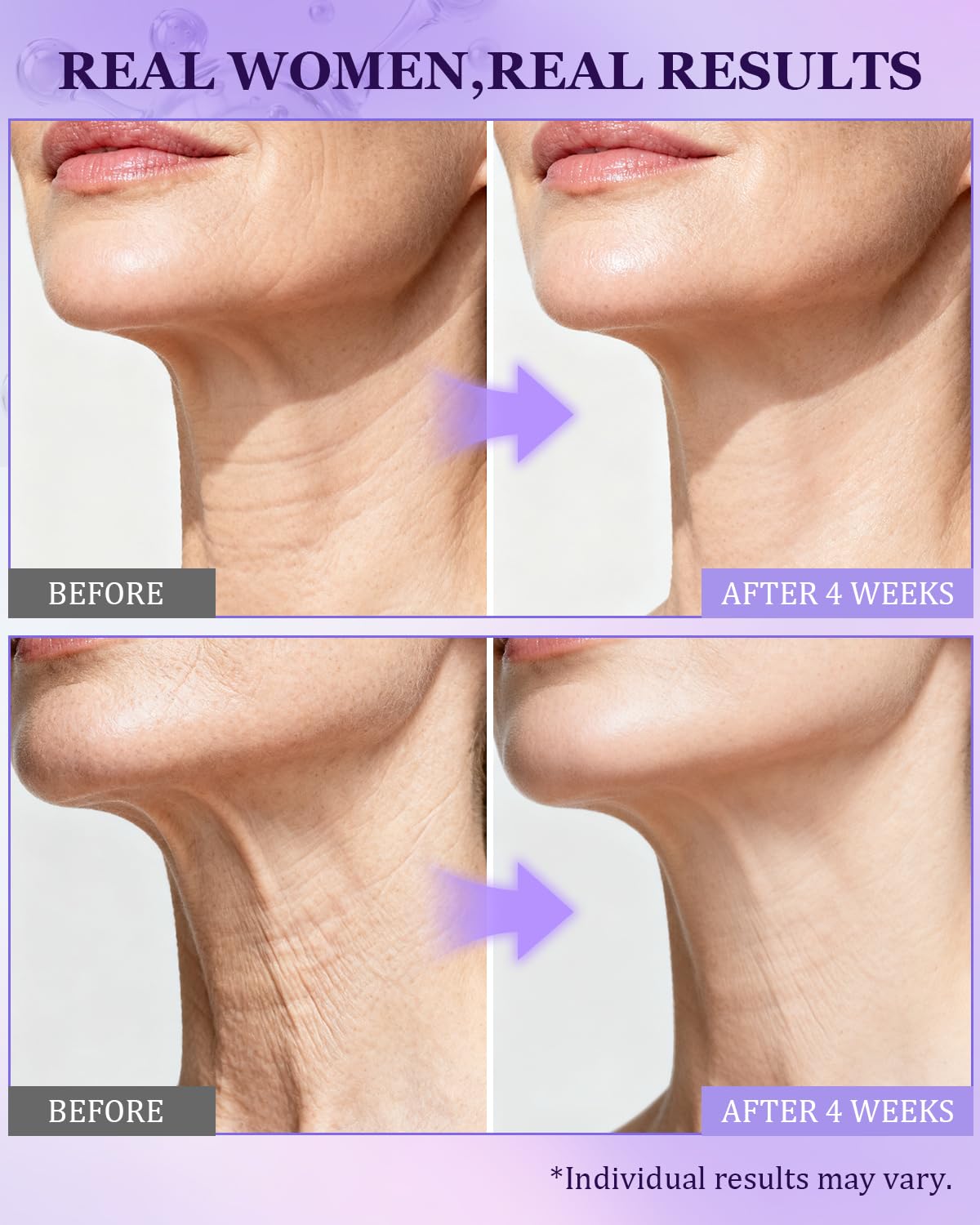 CHEOKINGBA 72H hydration visual emphasizes long-lasting moisture with ceramides.