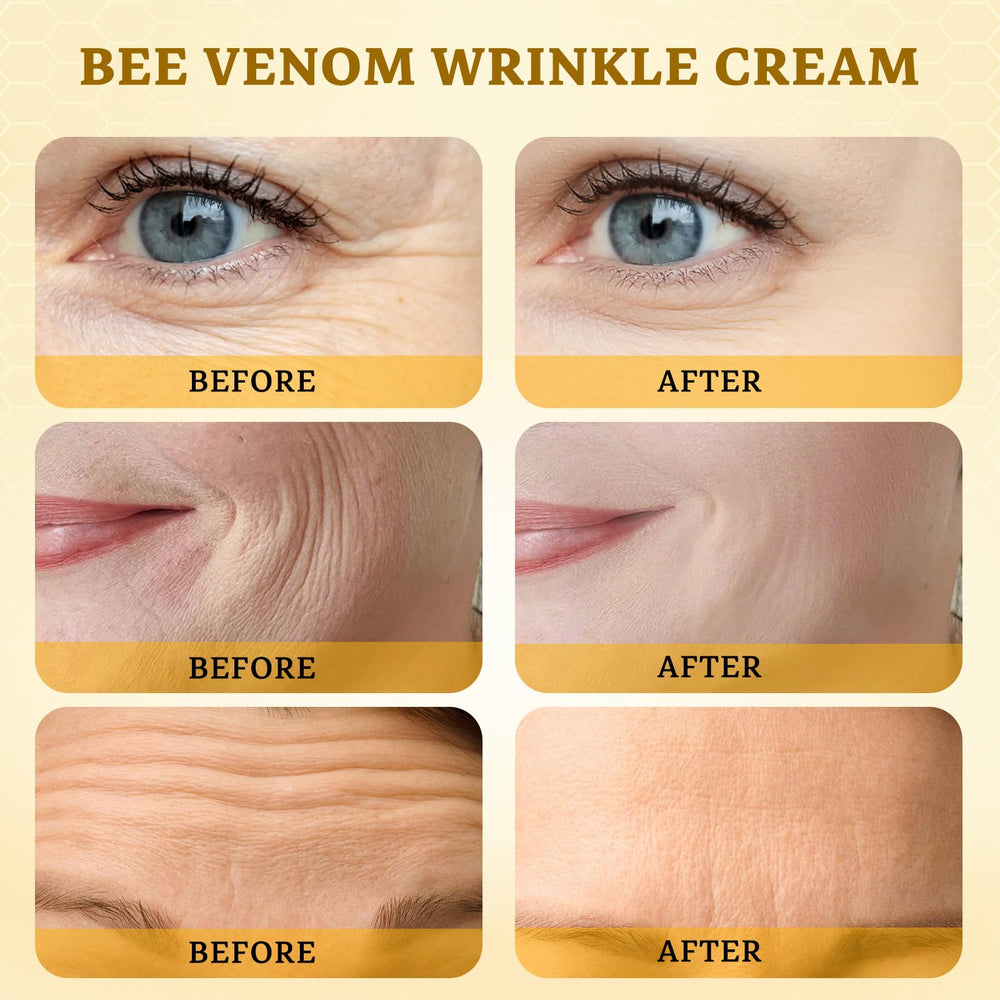 CHEOKINGBA Bee Venom Comprehensive Cream suitable for arms and neck, providing gentle daily nourishment.