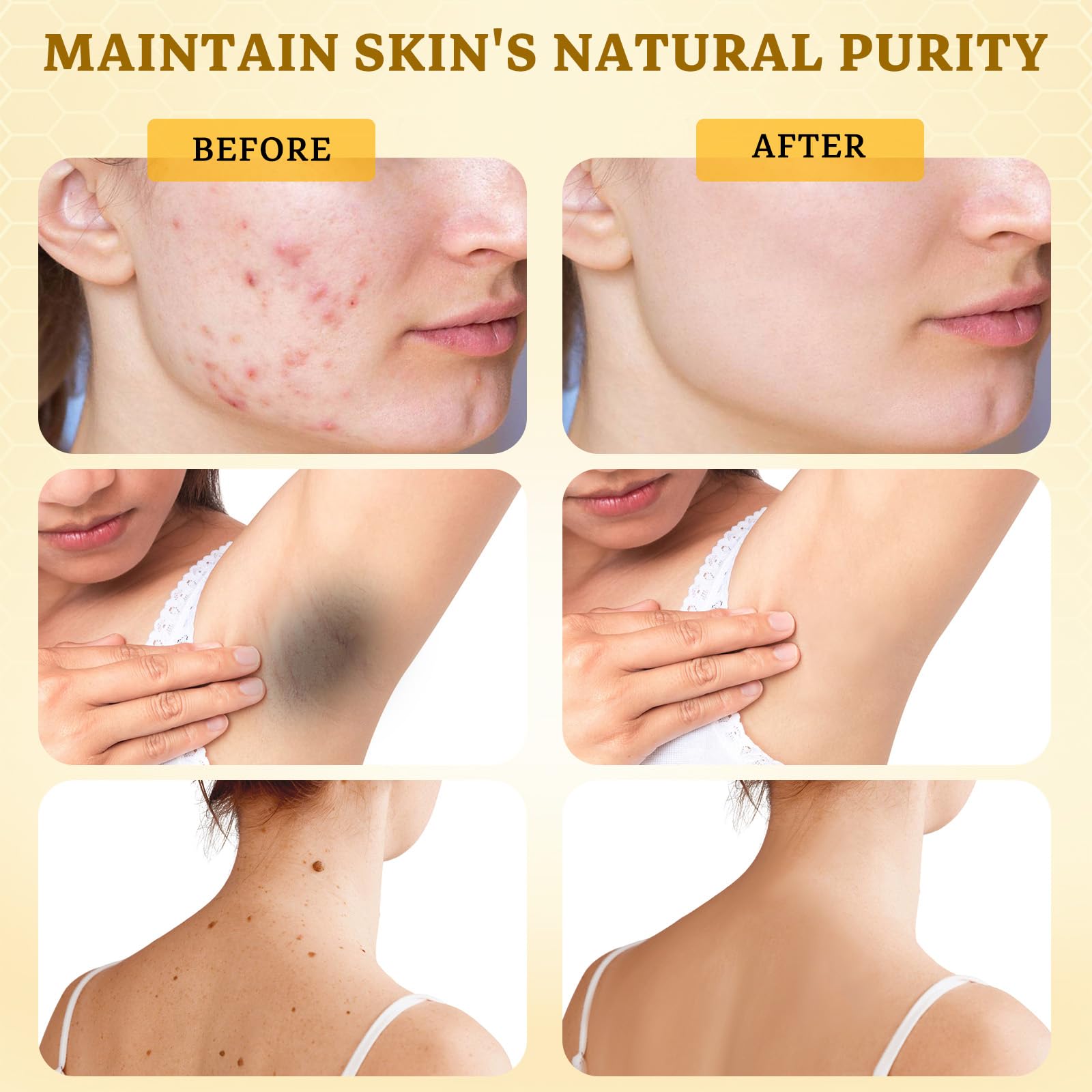 CHEOKINGBA Bee Venom Comprehensive Cream texture closeup reveals lightweight non-greasy feel.