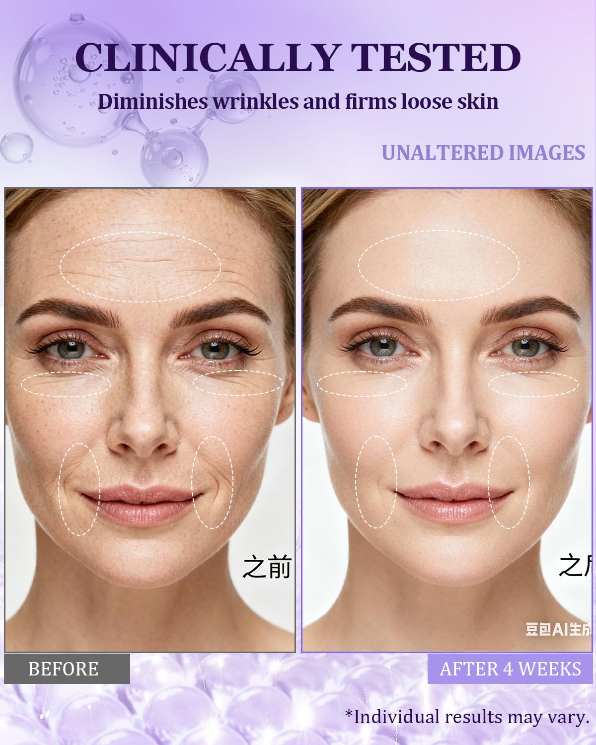 CHEOKINGBA product image highlights 1% retinol and 7% hyaluronic acid for potential wrinkle refinement.
