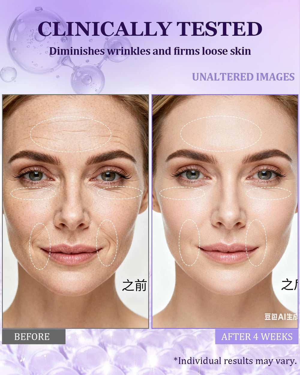 CHEOKINGBA product image highlights 1% retinol and 7% hyaluronic acid for potential wrinkle refinement.