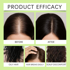 ChLNDalin Hair Regrowth System serum dropper for precise scalp application