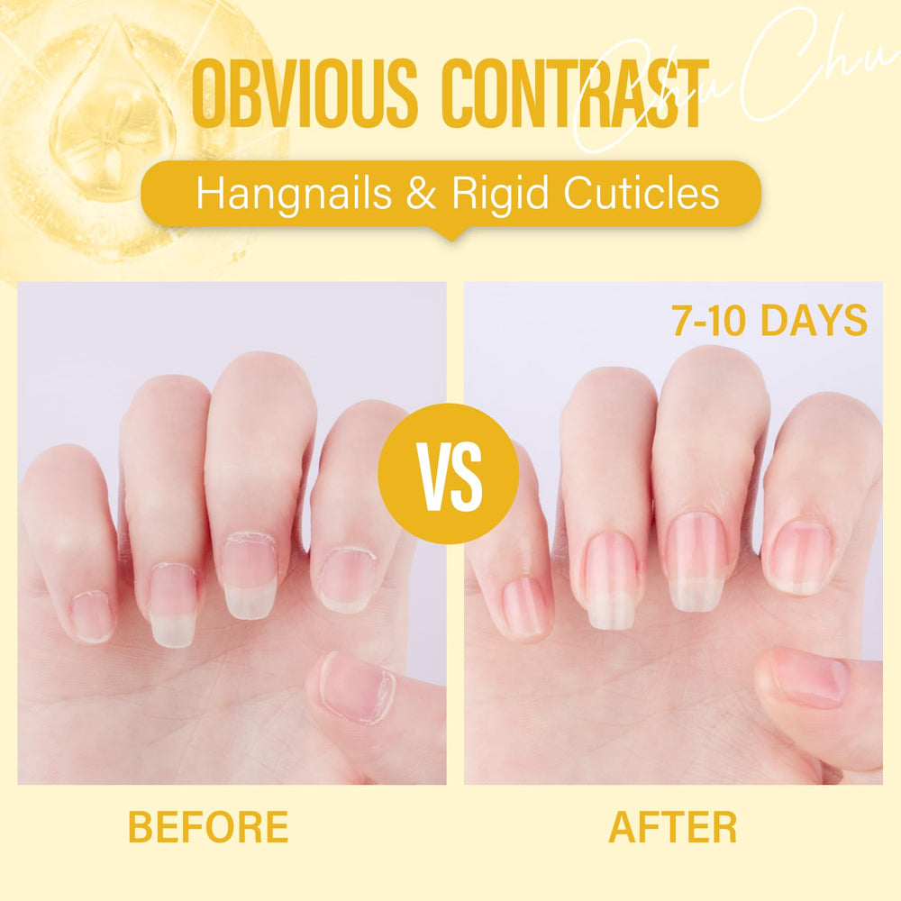 CHUCHU cuticle oil spa moment showing tropical scent and self-care ritual.