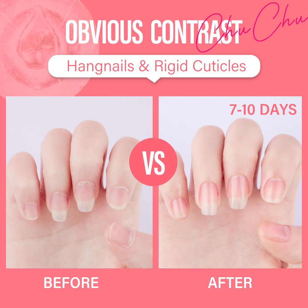 Chuchu nail growth support detail with before-and-after nails