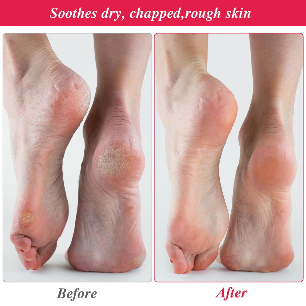 CIATBYYJ moisturizing socks paired with lotion to soften rough skin.