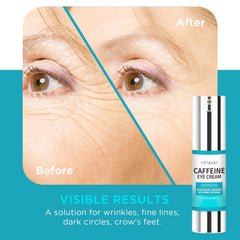 CITYGOO caffeine eye cream ingredients highlight peptides and retinol for nourishment