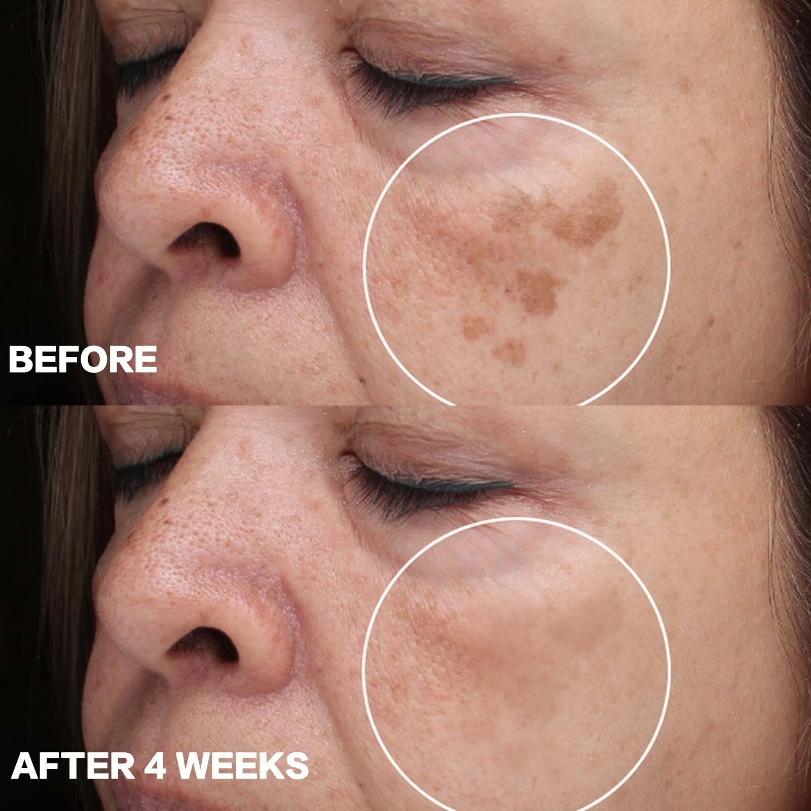 CITYGOO Dark Spot Remover day-night-use shot illustrating continuous care for brighter complexion.