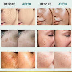 CITYGOO Dark Spot Remover ingredients-gentian-scabra close-up emphasizing balanced skin tone support.