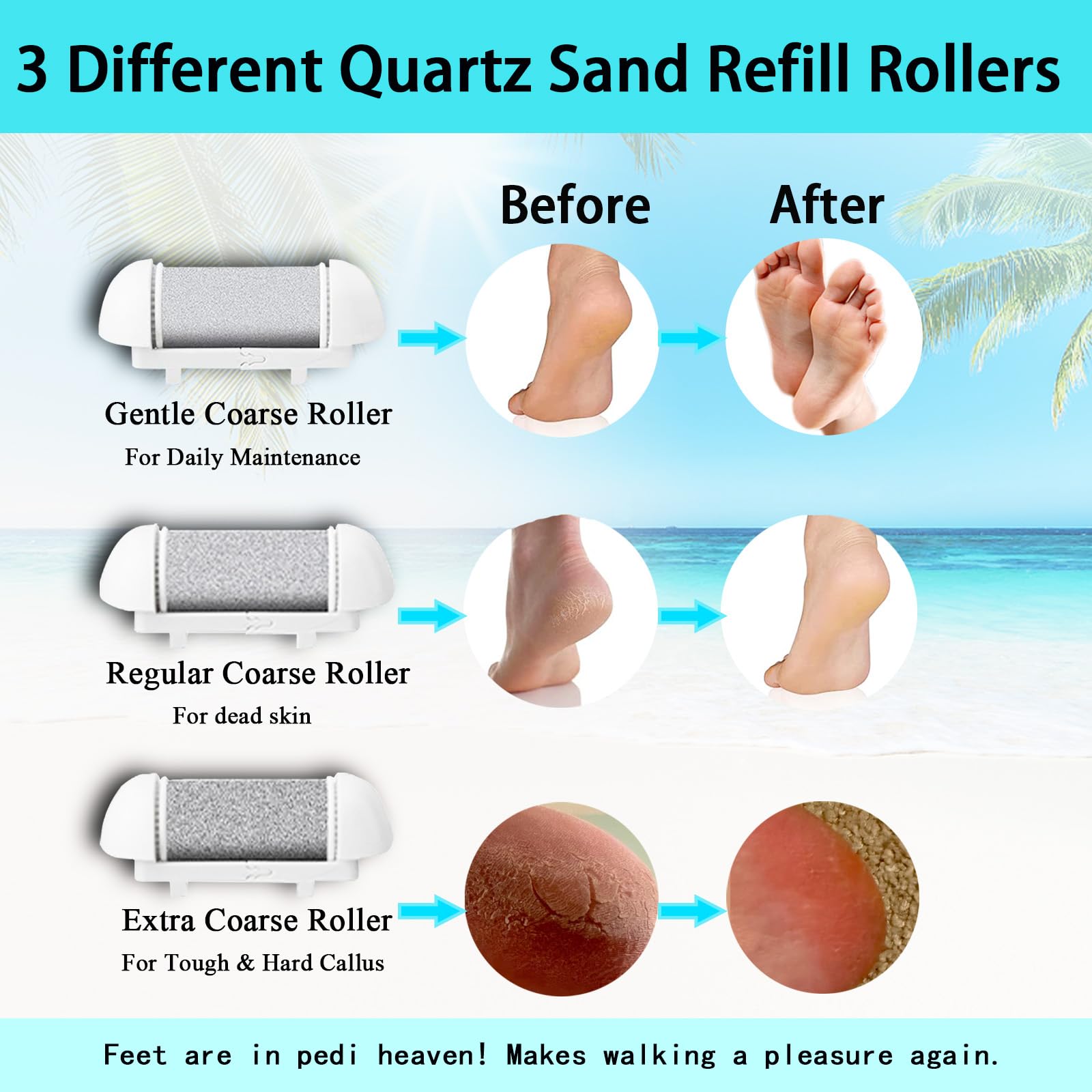 CIVYPRO roller heads exchange demonstrates customizable exfoliation.