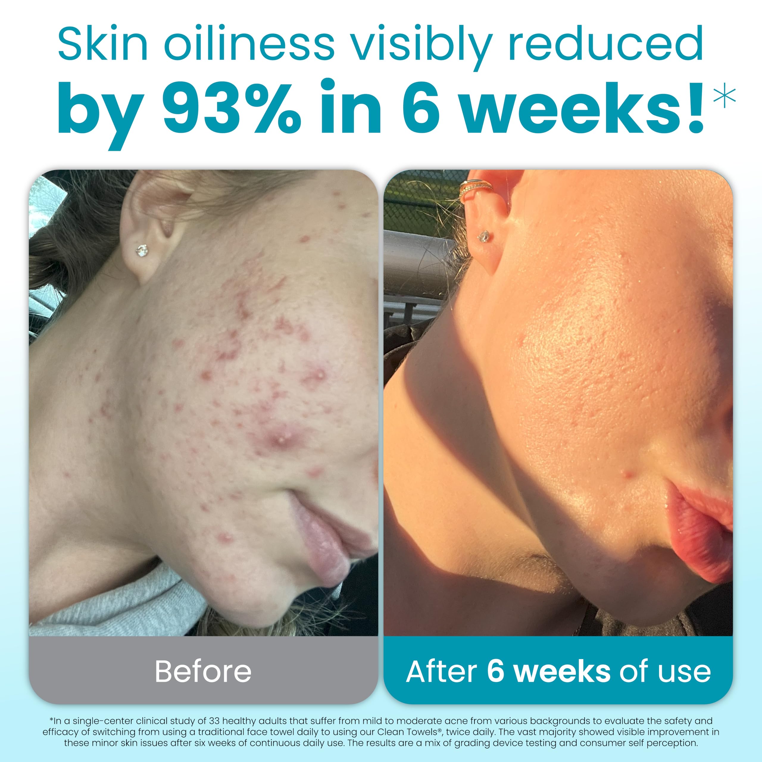 Clean Skin Club Blemish Control Clean Towels XL textured dots provide gentle exfoliation for clearer-looking skin.