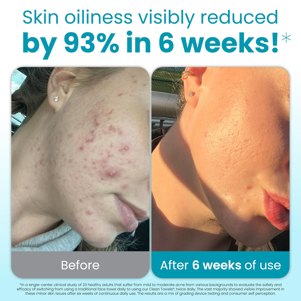 Clean Skin Club Blemish Control Clean Towels XL textured dots provide gentle exfoliation for clearer-looking skin.