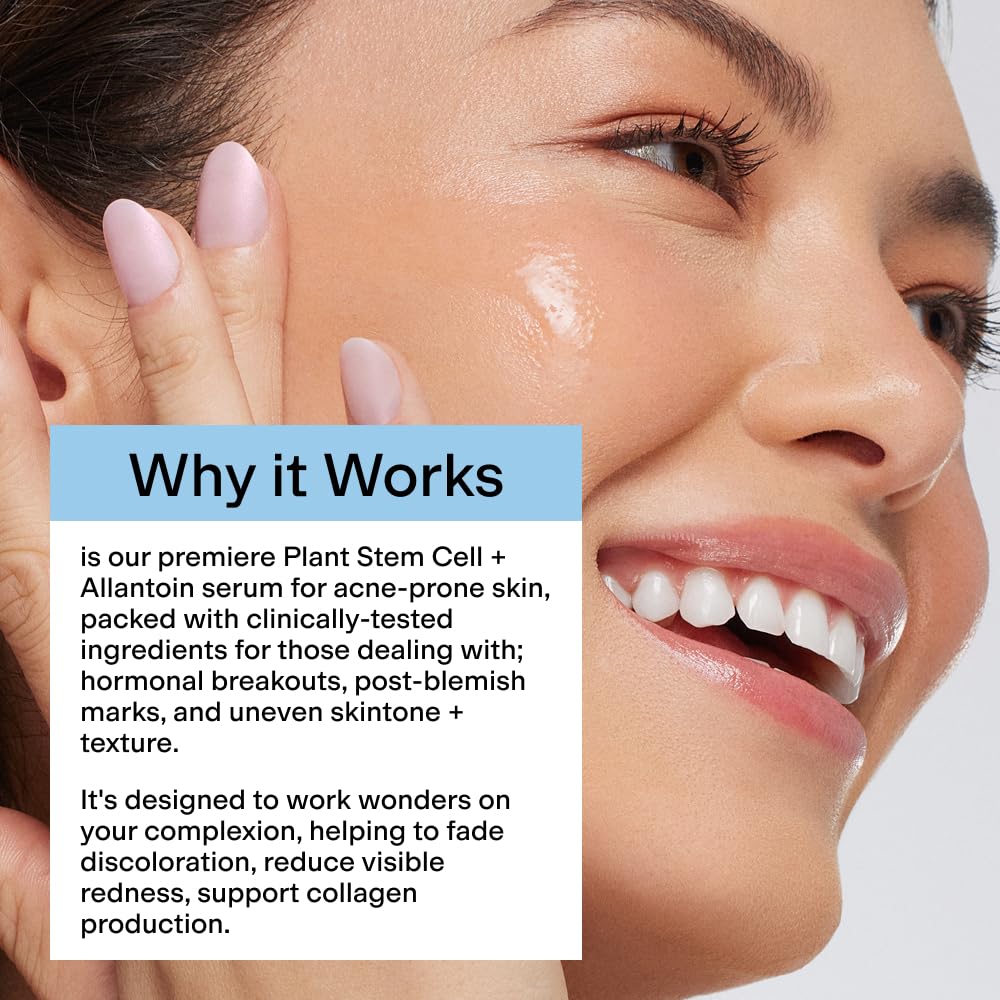 CLEARSTEM CELLRENEW turmeric visibly supports soothing irritation and calm skin surface