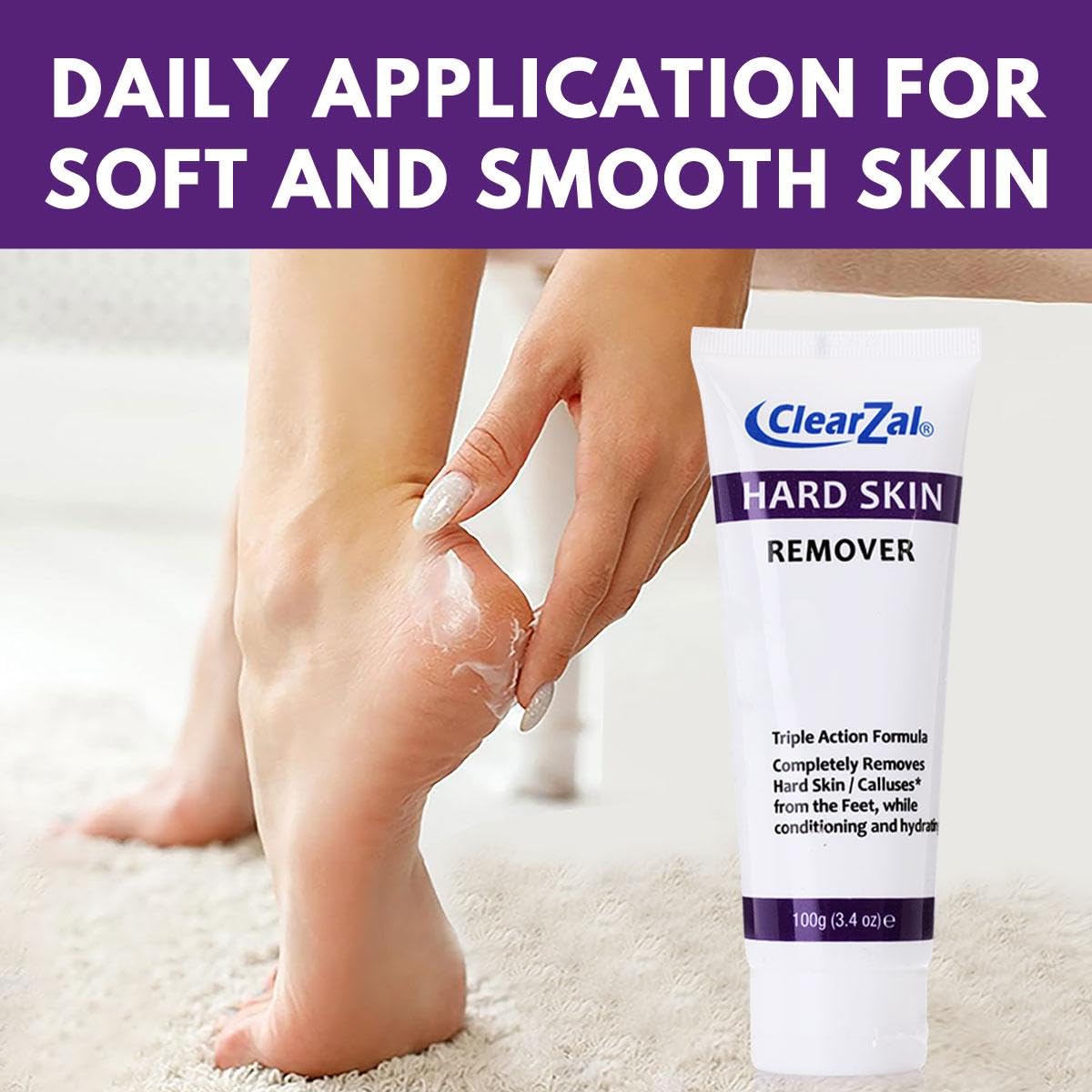 Clearzal foot cream targeting calluses and corns for relief