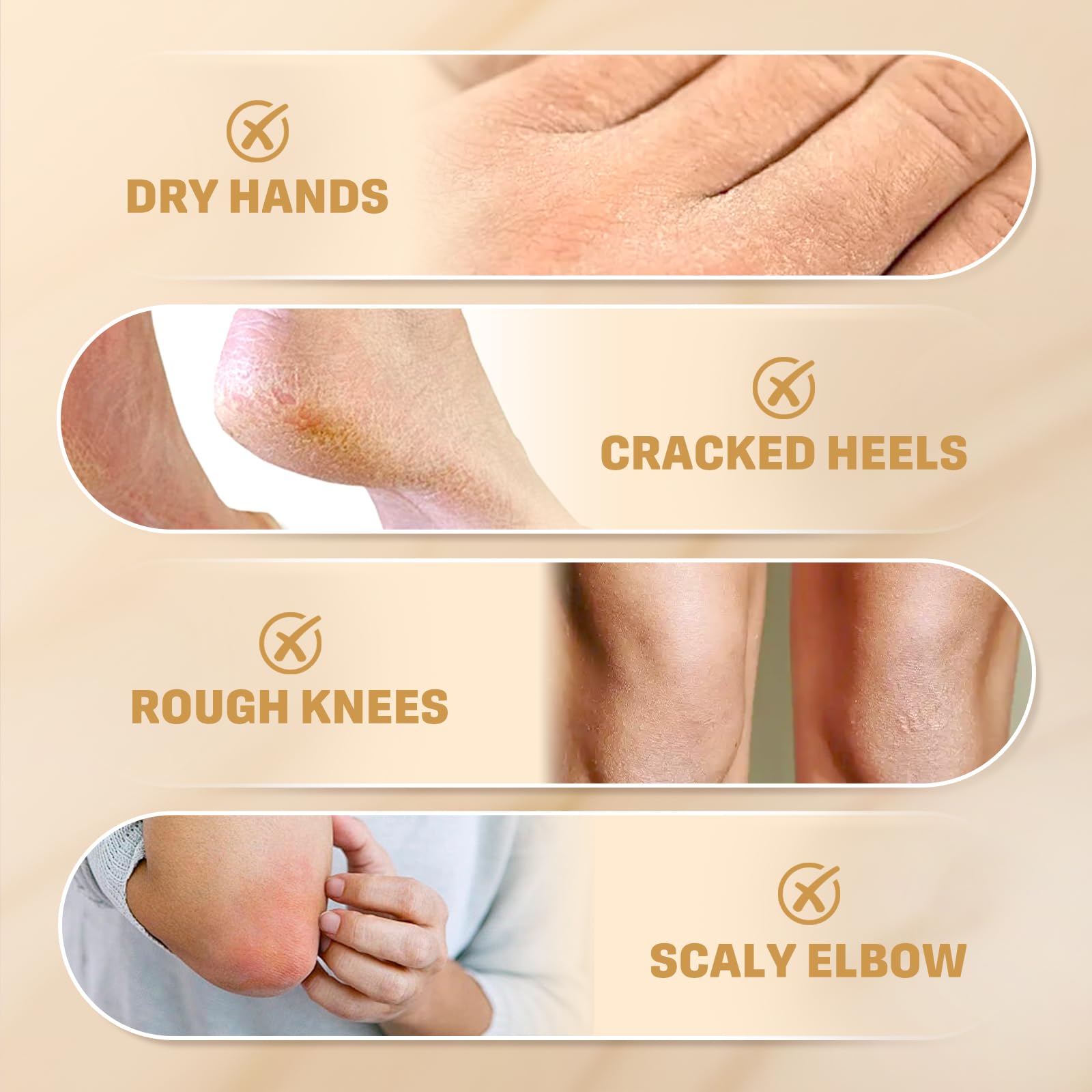 Clyecfra Elbow rough skin closeup demonstrates improved softness