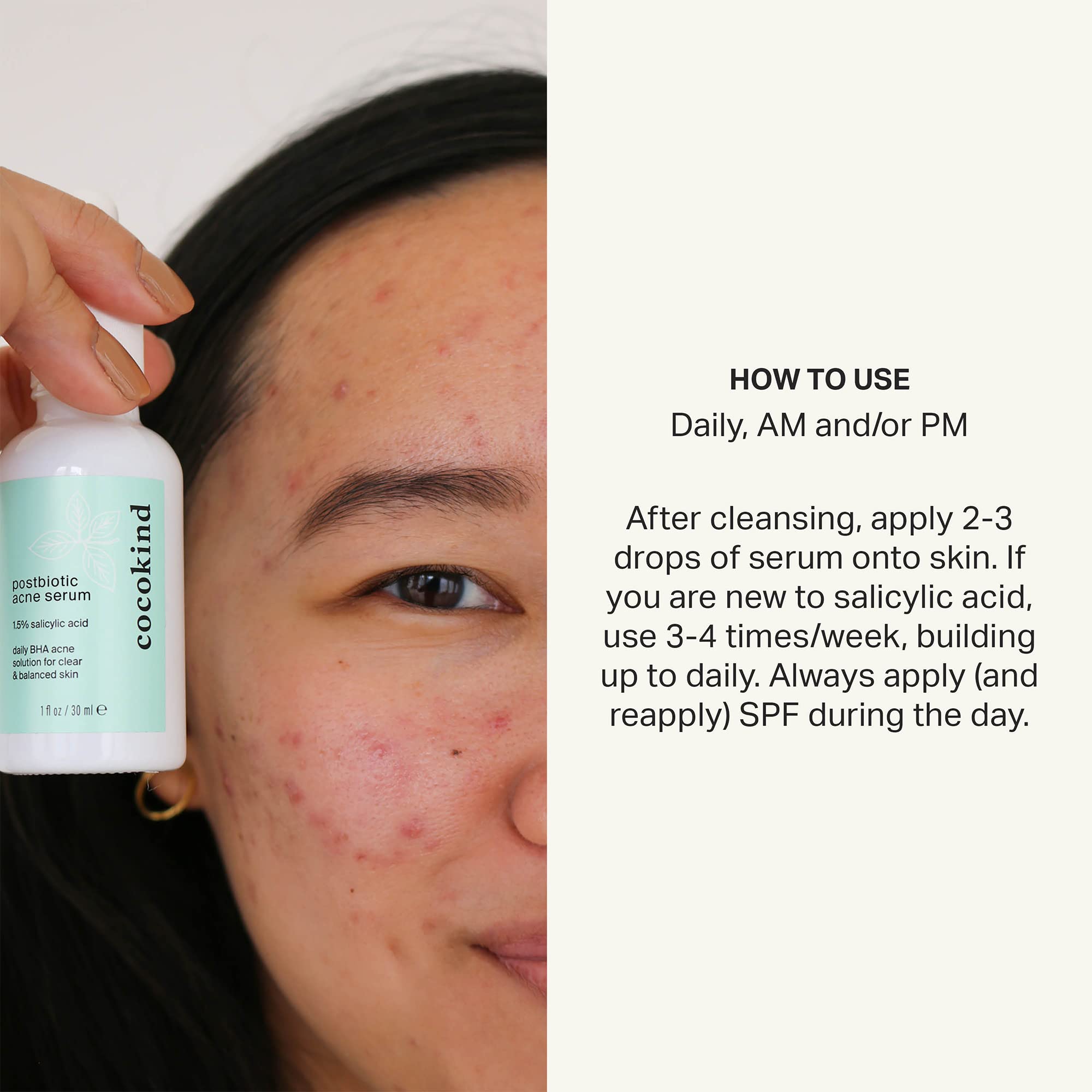 Cocokind Postbiotic Acne Serum on skin demonstrating pore decongestion.