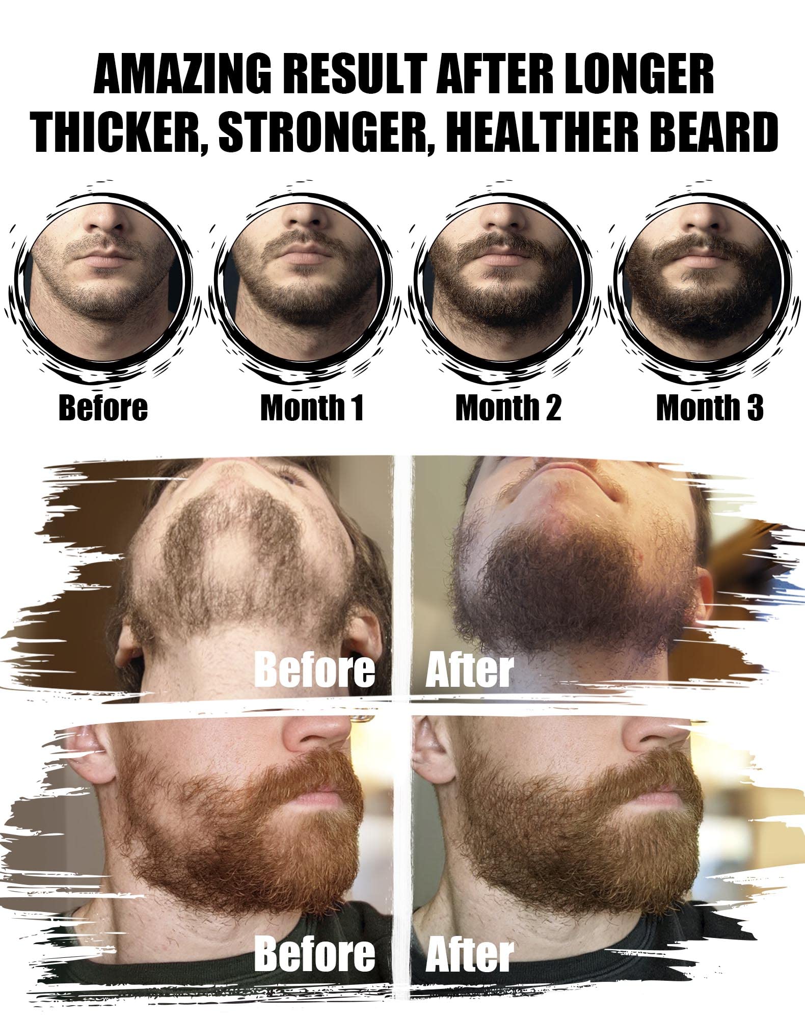 Beard grooming kit components laid out for easy routine