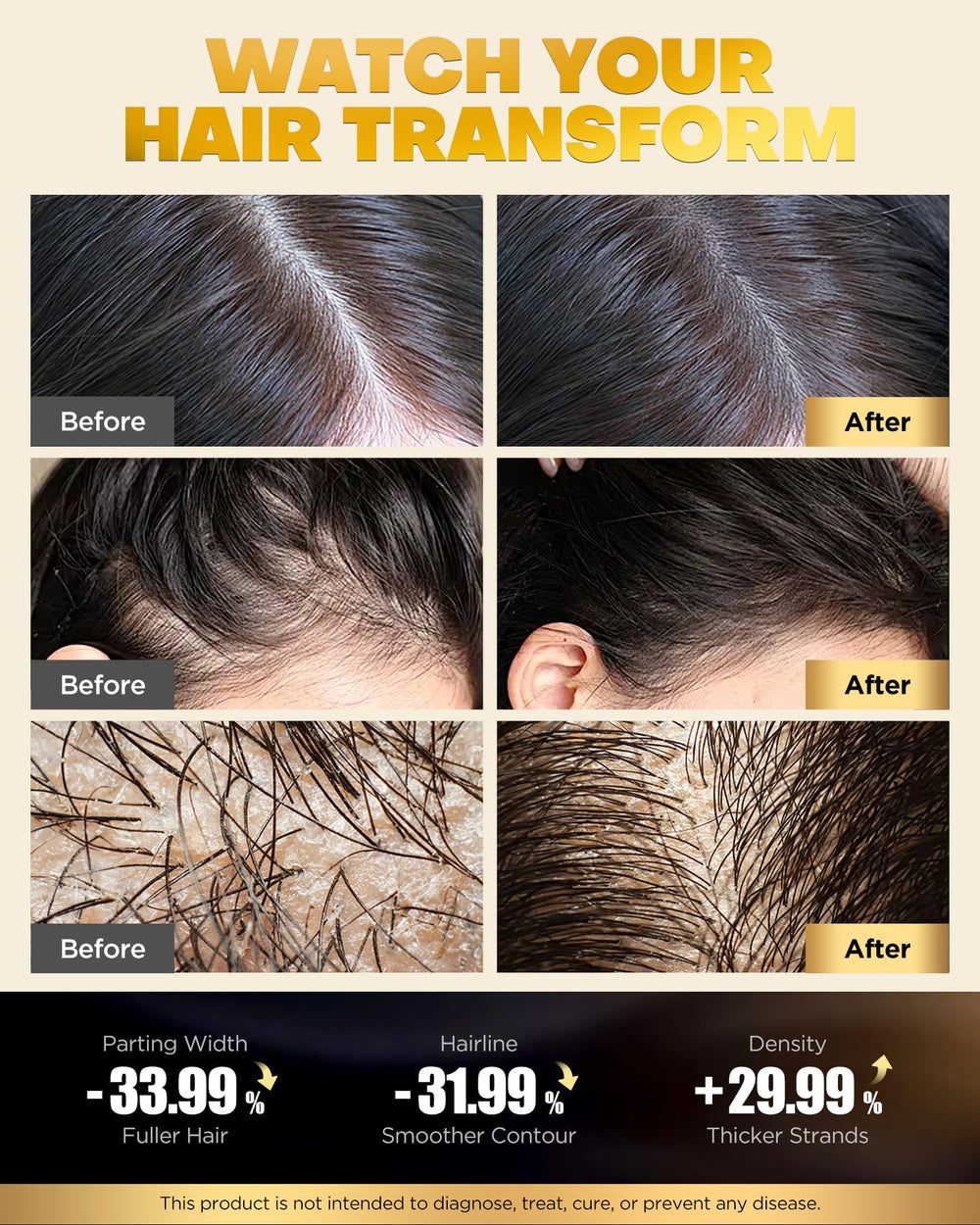 COOLKESI Rosemary Dandruff Shampoo foam clarifies scalp and reduces buildup.
